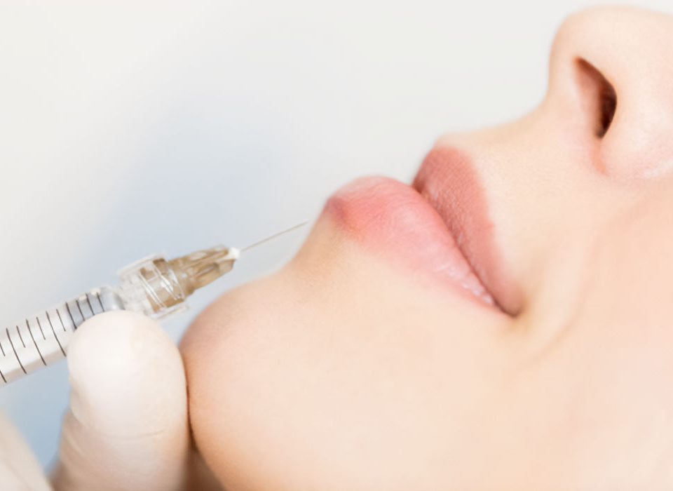 10 things you should know before dermal filler injection