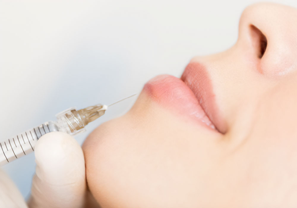 10 things you should know before dermal filler injection